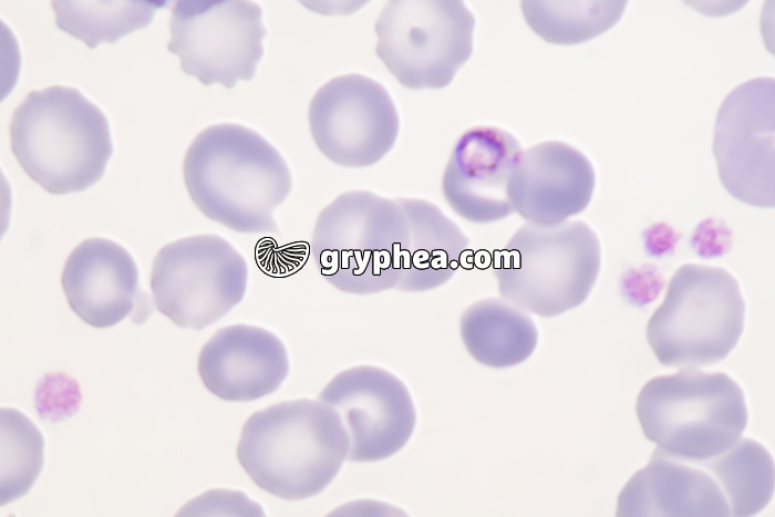 Plasmodium falciparum - Hématozoaire du paludisme x800 - gryphea.com